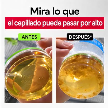 Antes y Después
